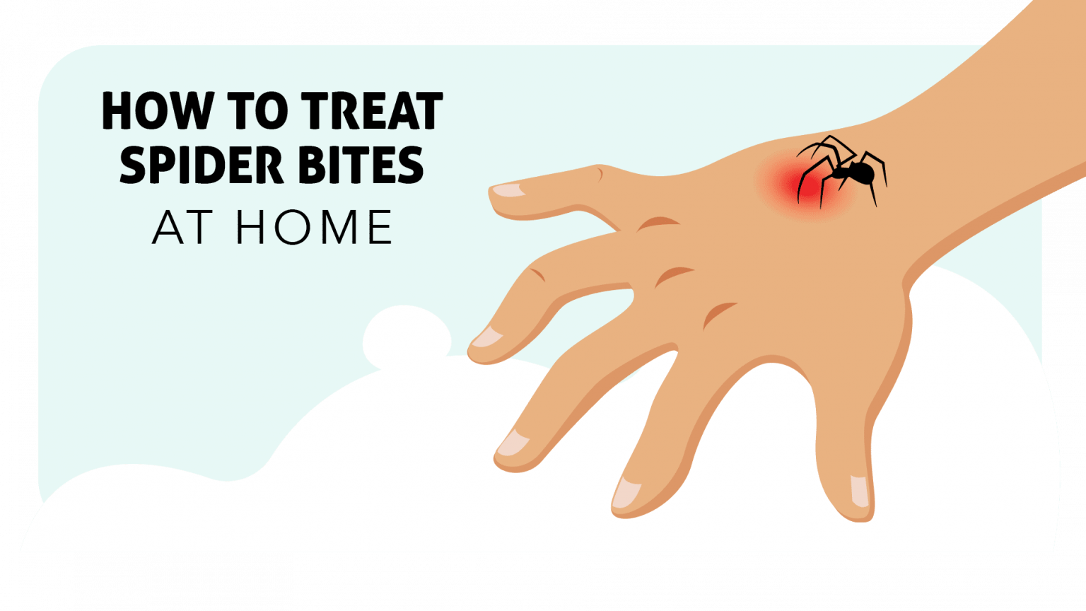 how-to-prevent-spider-bites-proven-strategies-for-keeping-spiders-away