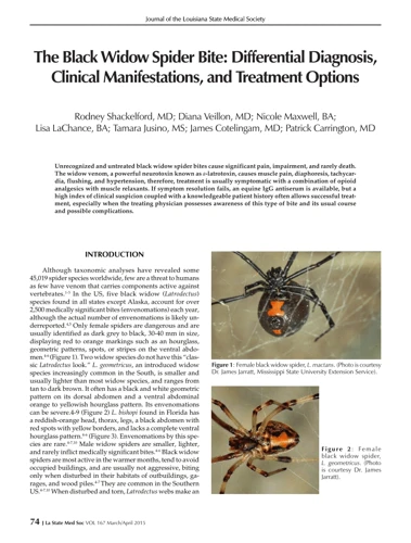 Other Treatment Options For Black Widow Spider Bites